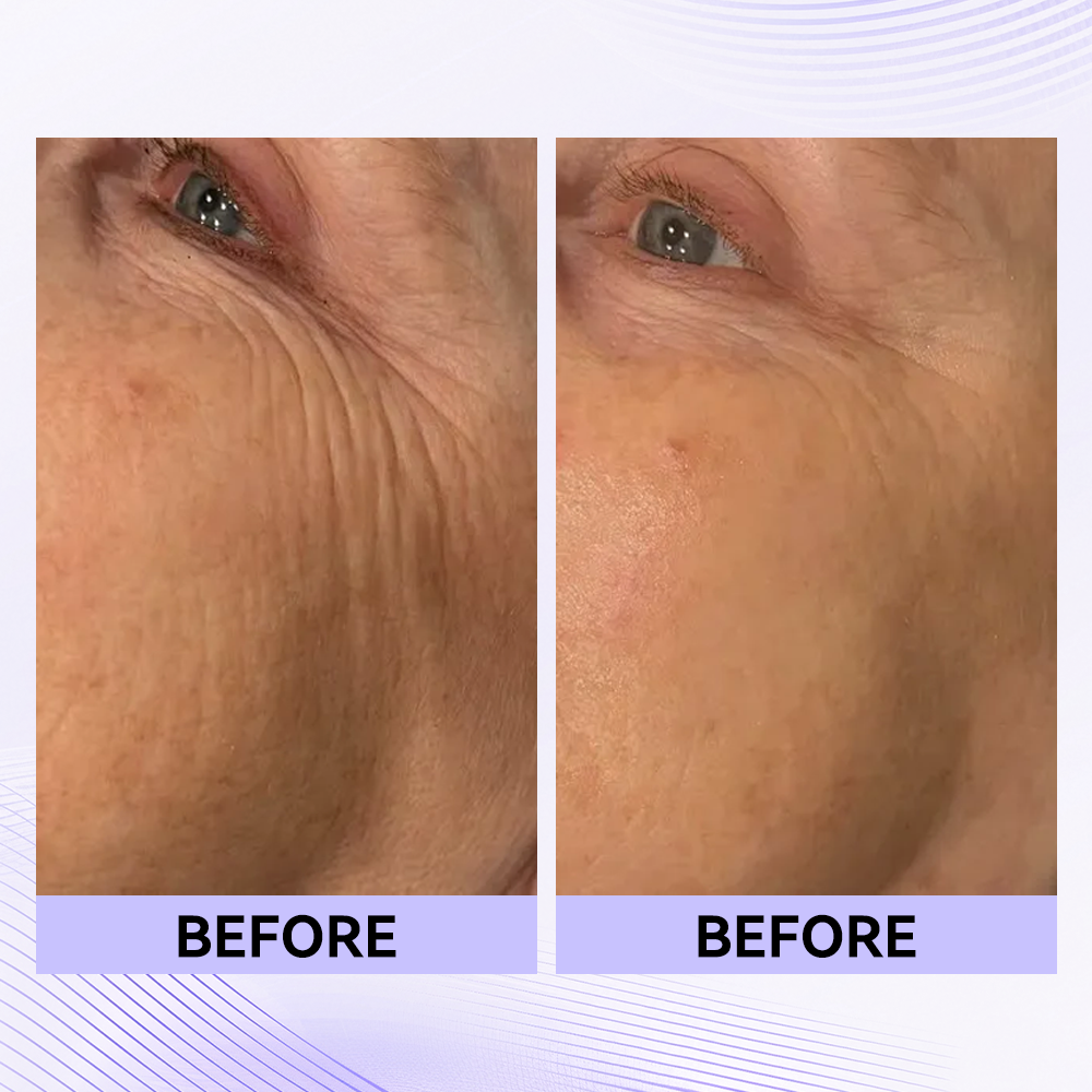 ✨Official New Arrival | Tightening eye contour gel patches