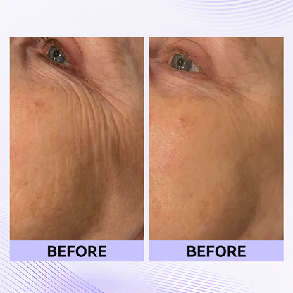 ✨Official New Arrival | Tightening eye contour gel patches