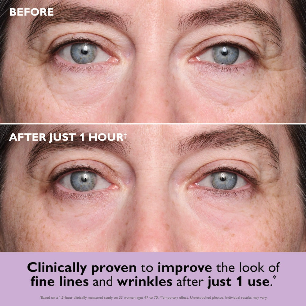 ✨Official New Arrival | Tightening eye contour gel patches