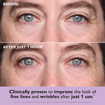 ✨Official New Arrival | Tightening eye contour gel patches
