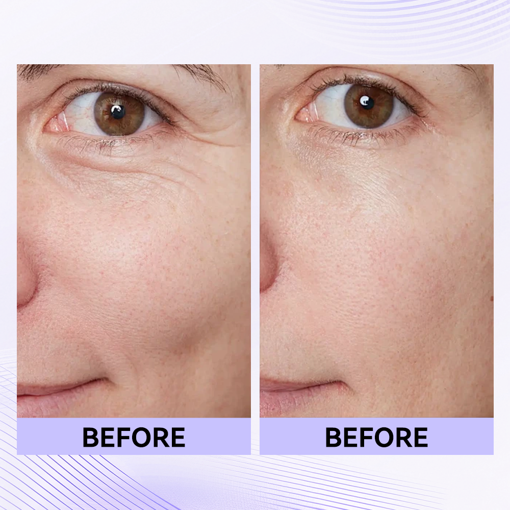✨Official New Arrival | Tightening eye contour gel patches