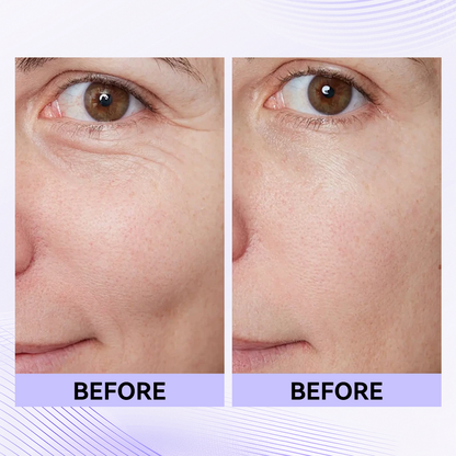 ✨Official New Arrival | Tightening eye contour gel patches