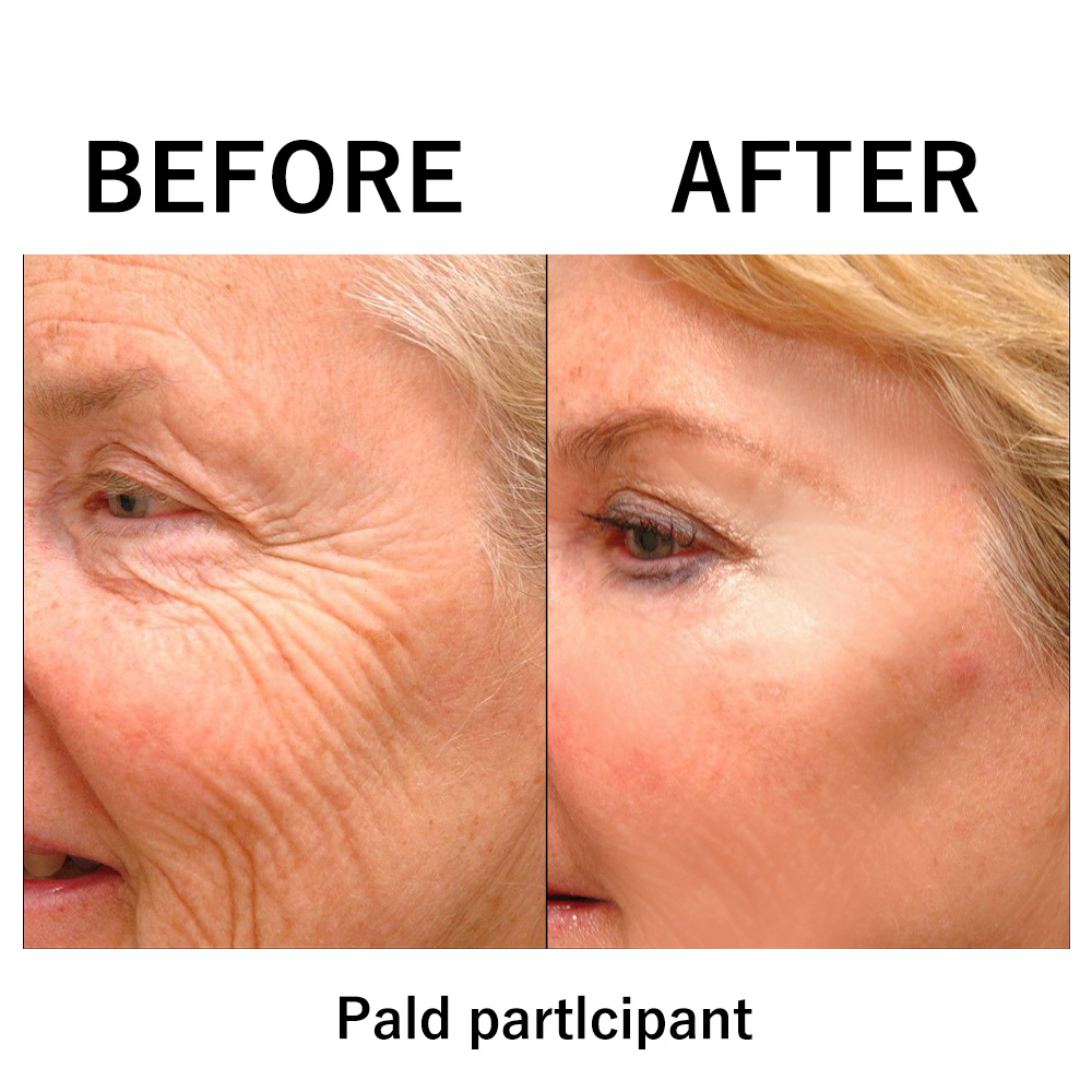 🎄🔥 Christmas Sale: Instant Face Tightener No-Filter Primer – 87% OFF! 🎅 Last Day Discount at the Official Brand Store! ✨